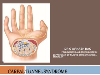 CARPAL TUNNEL SYNDROME
DR G AVINASH RAO
FELLOW HAND AND MICROSURGERY
DEPARTMENT OF PLASTIC SURGERY, SKIMS ,
SRINAGAR
 