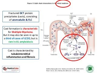 Plasma Cell Dyscrasias & The Kidney (How they affect the kidney? When ...