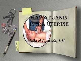 GAWAT JANIN
intra uterine

Leila N Ayuanda, S.ST
 