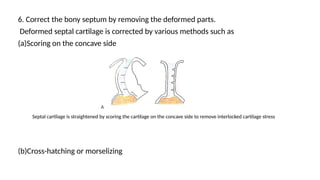 ear nose throat powerpoint presentation mbbs | PPTX