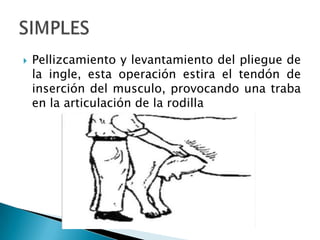  Pellizcamiento y levantamiento del pliegue de
la ingle, esta operación estira el tendón de
inserción del musculo, provocando una traba
en la articulación de la rodilla
 