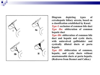 Gb And Pancreas (1) | PPT