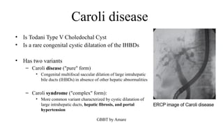 Caroli Types Radiologic anatomy of gallbladder and biliary tree | PPTX