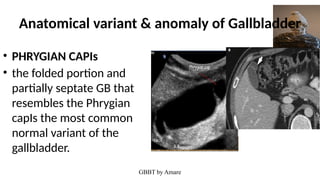 Radiologic anatomy of gallbladder and biliary tree | PPTX