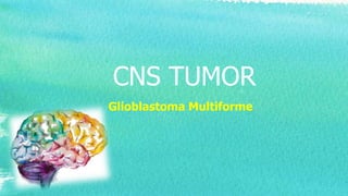 CNS TUMOR
Glioblastoma Multiforme
 