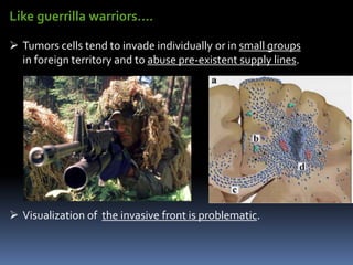 Like guerrilla warriors….
 Tumors cells tend to invade individually or in small groups
in foreign territory and to abuse pre-existent supply lines.
 Visualization of the invasive front is problematic.
 