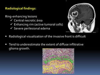 Radiological findings:
Ring-enhancing lesions
 Central necrotic área
 Enhancing rim (active tumoral cells)
 Severe perilesional edema
 Radiological visualization of the invasive front is difficult
 Tend to underestimate the extent of diffuse inflitrative
glioma growth.
 