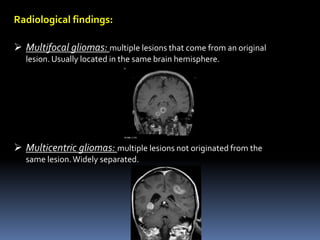 Radiological findings:
 Multifocal gliomas: multiple lesions that come from an original
lesion. Usually located in the same brain hemisphere.
 Multicentric gliomas: multiple lesions not originated from the
same lesion.Widely separated.
 