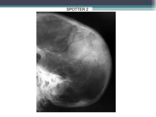 111
SPOTTER 2
 