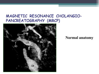 MAGNETIC RESONANCE CHOLANGIO-
PANCREATOGRAPHY (MRCP)
Normal anatomy
 