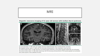 MRI
 