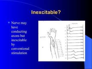 Inexcitable? Nerve may have conducting axons but inexcitable by conventional stimulation 