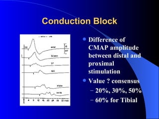 Conduction Block Difference of CMAP amplitude between distal and proximal stimulation Value ? consensus 20%, 30%, 50% 60% for Tibial  