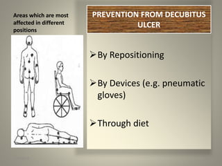 Areas which are most
affected in different
positions
PREVENTION FROM
DECUBITUS ULCER
By Repositioning
By Devices (e.g. pneumatic
gloves)
Through diet
1/30/2015 52
PREVENTION FROM DECUBITUS
ULCER
 