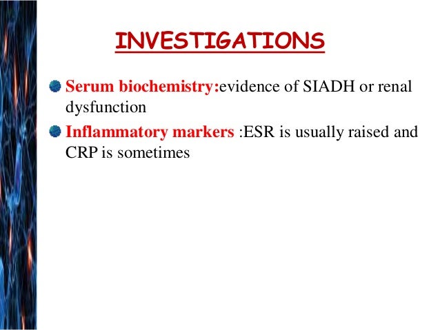 Guillain Barre Syndrome