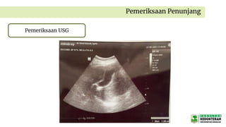 Pemeriksaan Penunjang
Pemeriksaan USG
 