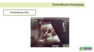 Pemeriksaan Penunjang
Pemeriksaan USG
 