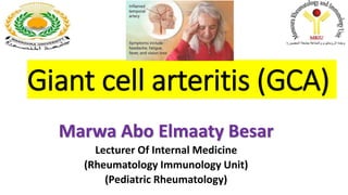 Giant cell arteritis (GCA)
Marwa Abo Elmaaty Besar
Lecturer Of Internal Medicine
(Rheumatology Immunology Unit)
(Pediatric Rheumatology)
 