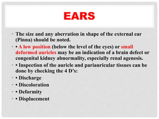 EARS
• The size and any aberration in shape of the external ear
(Pinna) should be noted.
• • A low position (below the level of the eyes) or small
deformed auricles may be an indication of a brain defect or
congenital kidney abnormality, especially renal agenesis.
• • Inspection of the auricle and pariauricular tissues can be
done by checking the 4 D’s:
• • Discharge
• • Discoloration
• • Deformity
• • Displacement
 