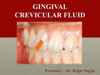 GINGIVAL
CREVICULAR FLUID
Presenter – Dr. Rajat Singla
 