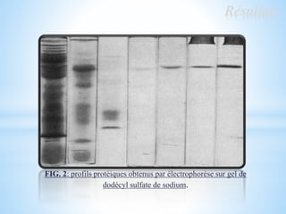 Résultats
FIG. 2: profils protéiques obtenus par électrophorèse sur gel de
dodécyl sulfate de sodium.
 