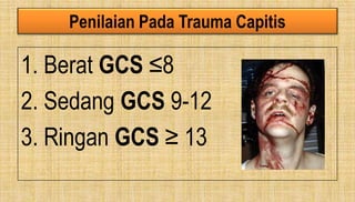 Penilaian Pada Trauma Capitis
1. Berat GCS ≤8
2. Sedang GCS 9-12
3. Ringan GCS ≥ 13
 