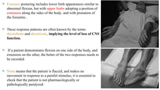 glasgow coma scale gcs 2 [Autosaved].pptx
