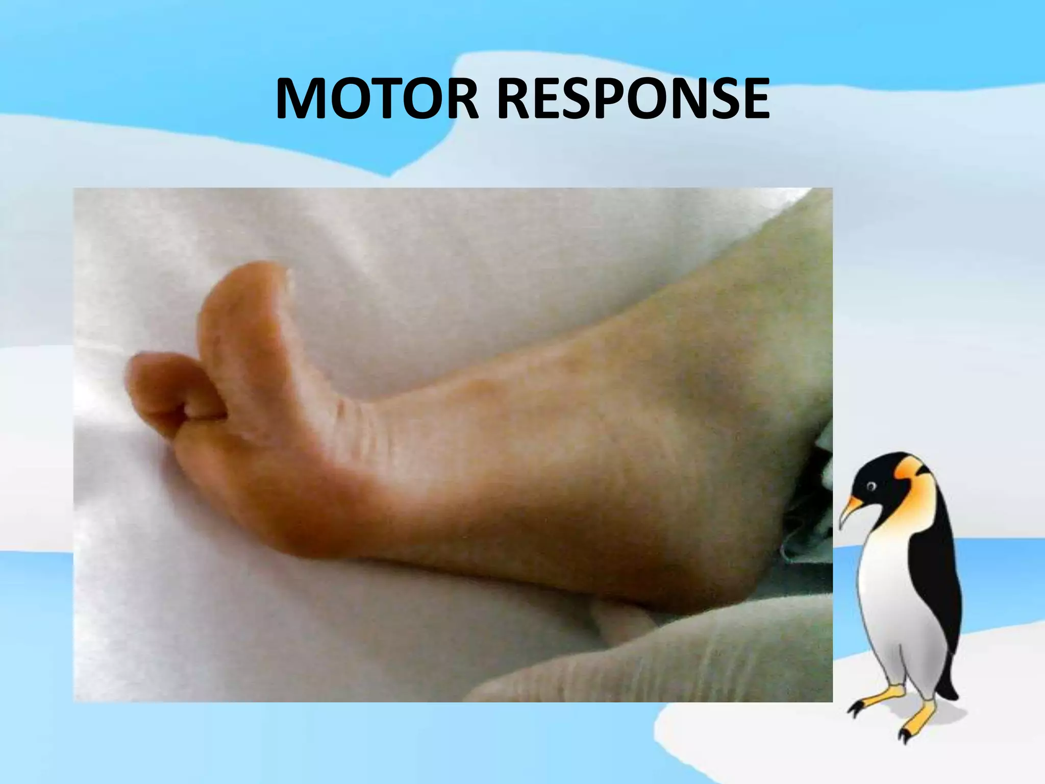 MOTOR RESPONSE