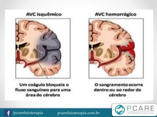 pcarefisioterapia.com.br/pcarefisioterapia
 