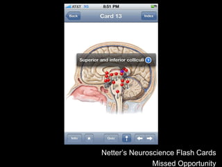 Netter’s Neuroscience Flash Cards Missed Opportunity 