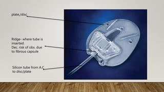 Silicon tube from A.C
to disc/plate
Ridge- where tube is
inserted.
Dec. risk of obs. due
to fibrous capsule
plate,/disc
 