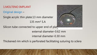 1.MOLTENO IMPLANT
Original design –
Single acrylic thin plate:13 mm diameter
135 mm² S.A
Silicon tube connected to upper end of plate
external diameter-0.62 mm
internal diameter-0.30 mm
Thickened rim which is perforated facilitating suturing to sclera
 