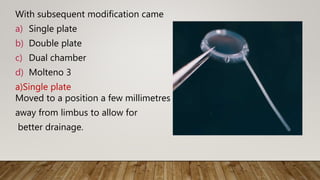 With subsequent modification came
a) Single plate
b) Double plate
c) Dual chamber
d) Molteno 3
a)Single plate
Moved to a position a few millimetres
away from limbus to allow for
better drainage.
 