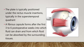 • The plate is typically positioned
under the rectus muscle insertions,
typically in the superotemporal
quadrant
• A fibrous capsule forms after the first
3 to 6 postoperative weeks into which
fluid can drain and from which fluid
can be absorbed by the surrounding
tissues.
 