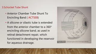 3.Schocket Tube Shunt
• Anterior Chamber Tube Shunt To
Encircling Band ( ACTSEB)
• A silicone or silastic tube is extended
from the anterior chamber to a 360°
encircling silicone band, as used in
retinal detachment repair, which
functioned in developing the reservoir
for aqueous drainage.
 