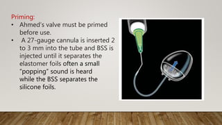 Priming:
• Ahmed’s valve must be primed
before use.
• A 27-gauge cannula is inserted 2
to 3 mm into the tube and BSS is
injected until it separates the
elastomer foils often a small
“popping” sound is heard
while the BSS separates the
silicone foils.
 