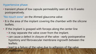 Hypertensive phase:
• transient phase of low capsule permeability seen at 4 to 8 weeks
postoperatively.
“No-touch zone” on the Ahmed glaucoma valve:
• It is the area of the implant covering the chamber with the silicone
leaflets.
• If the implant is grasped with forceps along the center line
• it may separate the valve cover from the implant.
• can cause a defect in closure of the valve - early postoperative
hypotony and fibrovascular membrane ingrowth between the
leaflets.
• lead to a failure of the valve due to adhesion of the valve
membranes.
 