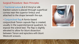 Surgical Procedure- Basic Principles
• Tractional suture:A 6-0 Vicryl or silk
traction suture is placed through superficial
cornea near the superior limbus and
attached to the drape beneath the eye.
• Conjunctival flap:A fornix-based
conjunctival-Tenon capsule flap is created,
usually in the superotemporal quadrant, to
expose the scleral bed. The flap is slightly
elevated to allow for blunt dissection
between Tenon and episclera with blunt
Westcott scissors.
 