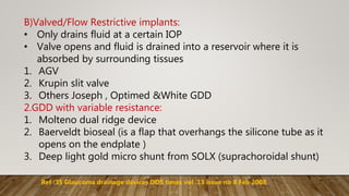 B)Valved/Flow Restrictive implants:
• Only drains fluid at a certain IOP
• Valve opens and fluid is drained into a reservoir where it is
absorbed by surrounding tissues
1. AGV
2. Krupin slit valve
3. Others Joseph , Optimed &White GDD
2.GDD with variable resistance:
1. Molteno dual ridge device
2. Baerveldt bioseal (is a flap that overhangs the silicone tube as it
opens on the endplate )
3. Deep light gold micro shunt from SOLX (suprachoroidal shunt)
Ref :35 Glaucoma drainage devices DOS times vol .13 issue no 8 Feb 2008
 