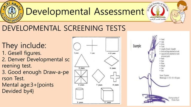 Global Developmental Delay (GDD) | PPT