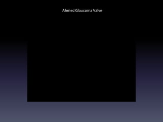 Ahmed GlaucomaValve
 
