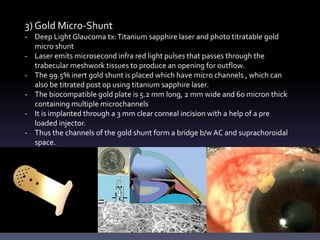 3) Gold Micro-Shunt
- Deep Light Glaucoma tx:Titanium sapphire laser and photo titratable gold
micro shunt
- Laser emits microsecond infra red light pulses that passes through the
trabecular meshwork tissues to produce an opening for outflow.
- The 99.5% inert gold shunt is placed which have micro channels , which can
also be titrated post op using titanium sapphire laser.
- The biocompatible gold plate is 5.2 mm long, 2 mm wide and 60 micron thick
containing multiple microchannels
- It is implanted through a 3 mm clear corneal incision with a help of a pre
loaded injector.
- Thus the channels of the gold shunt form a bridge b/w AC and suprachoroidal
space.
 