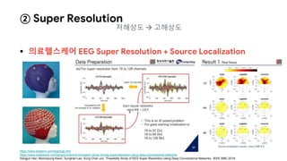  의료헬스케어 EEG Super Resolution + Source Localization
https://www.biosemi.com/headcap.htm
https://www.slideshare.net/SangJunHan4/a-simulation-study-of-eeg-superresolution-using-deep-convolutional-networks
Sangjun Han, Moonyoung Kwon, Sunghan Lee, Sung Chan Jun, ‘Feasibility Study of EEG Super-Resolution Using Deep Convolutional Networks,’ IEEE SMC 2018.
② Super Resolution
저해상도  고해상도
 