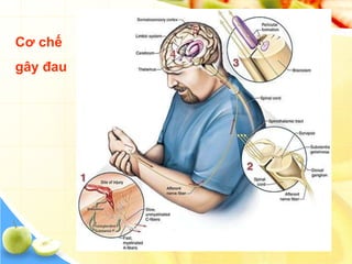Cơ chế
gây đau
 