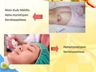 Nhóm thuốc NSAIDs
Alpha chymotrypsin
Serratiopeptidase.




                     Alphachymotrypsin
                     Serratiopeptidase.
 