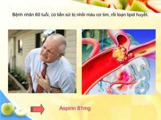 Bệnh nhân 60 tuổi, có tiền sử bị nhồi máu cơ tim, rối loạn lipid huyết.




                        Aspirin 81mg
 