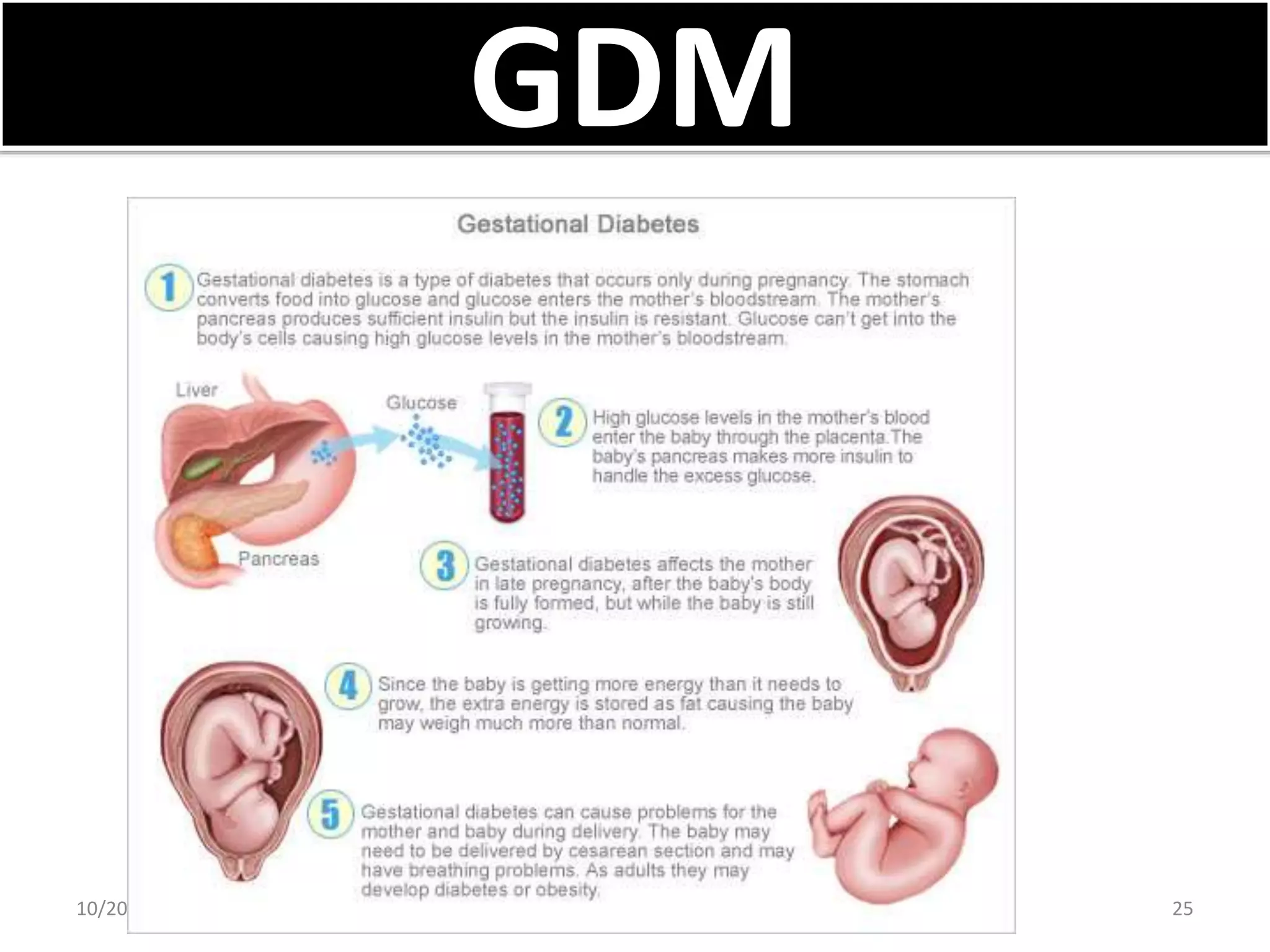 Gestational Diabetes Mellitus and Nursing Management | PPSX