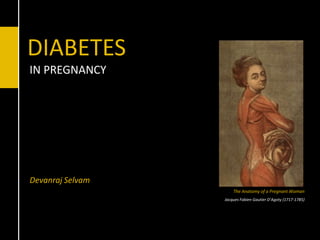 DIABETESIN PREGNANCY Devanraj Selvam The Anatomy of a Pregnant Woman Jacques Fabien Gautier D’Agoty (1717-1785) 