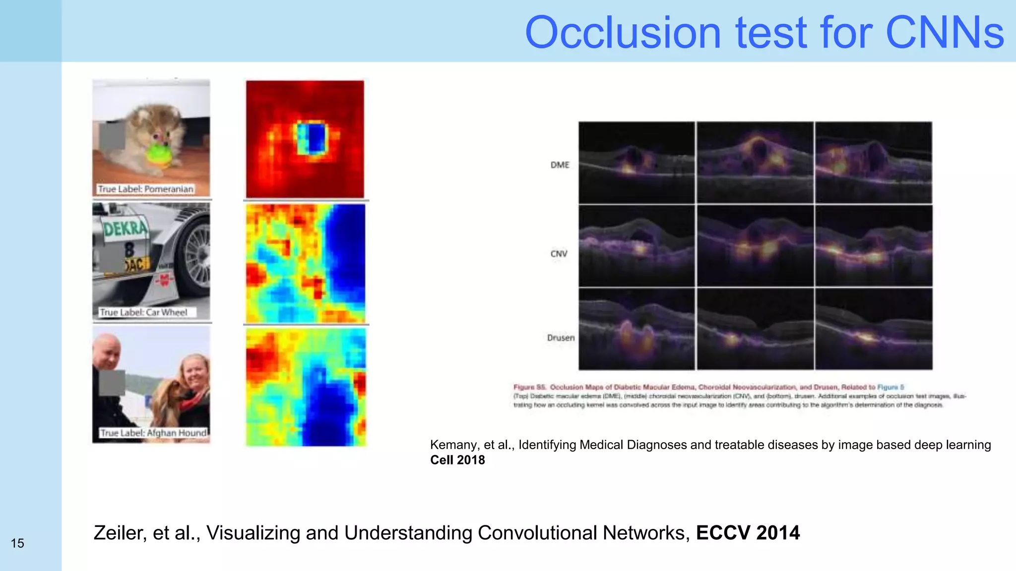15
Occlusion test for CNNs
Kemany, et al., Identifying Medical Diagnoses and treatable diseases by image based deep learning
Cell 2018
Zeiler, et al., Visualizing and Understanding Convolutional Networks, ECCV 2014
 