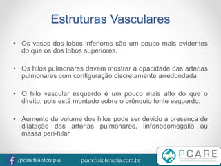 pcarefisioterapia.com.br/pcarefisioterapia
Estruturas Vasculares
• Os vasos dos lobos inferiores são um pouco mais evidentes
do que os dos lobos superiores.
• Os hilos pulmonares devem mostrar a opacidade das arterias
pulmonares com configuração discretamente arredondada.
• O hilo vascular esquerdo é um pouco mais alto do que o
direito, pois está montado sobre o brônquio fonte esquerdo.
• Aumento de volume dos hilos pode ser devido à presença de
dilatação das artérias pulmonares, linfonodomegalia ou
massa peri-hilar
 
